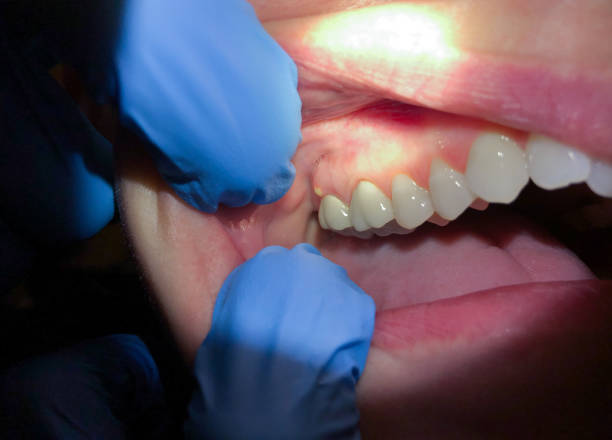 Best Weekend Emergency Dentist in Landen, OH