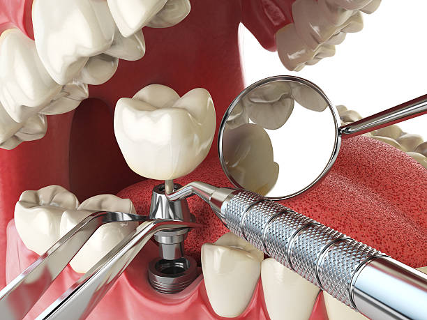 Best Emergency Dentist for Special Needs Patients in Landen, OH