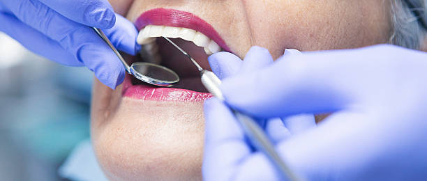 Best Emergency Dentist for Special Needs Patients in Landen, OH